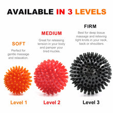 Load image into Gallery viewer, Spiky Massage Ball
